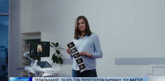Βόλος Ξεπαπαδάκης: Το 85% των περιπτώσεων καρκίνου του μαστού είναι ιάσιμο αν… 250926